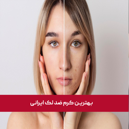 بهترین کرم ضد لک ایرانی